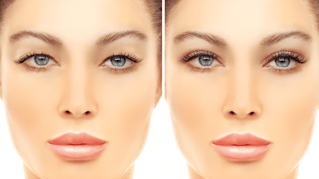 asian-blepharoplasty-barbies-beauty-bits