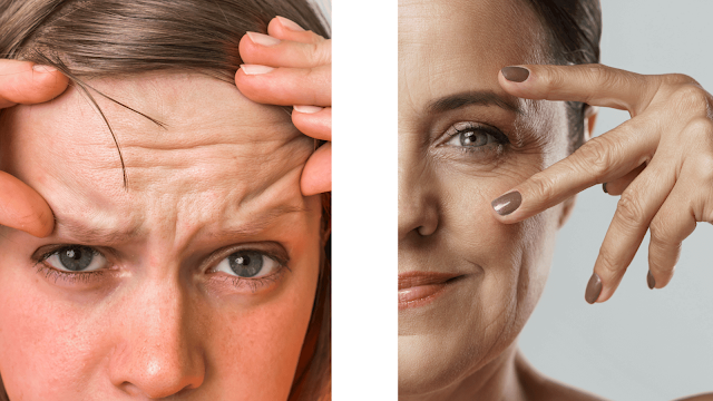 best-cosmetic-treatments-for-wrinkles-look-barbies-beauty-bits