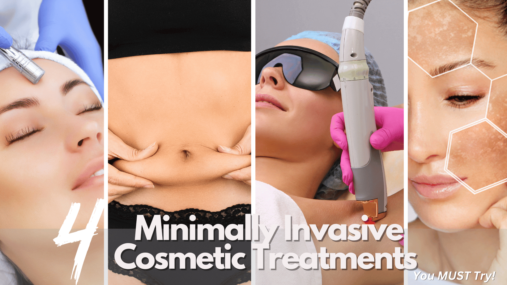 top-4-minimally-invasive-cosmetic-treatments-you-must-try-barbies-beauty-bits top-4-minimally-invasive-cosmetic-treatments-you-must-try-barbies-beauty-bits