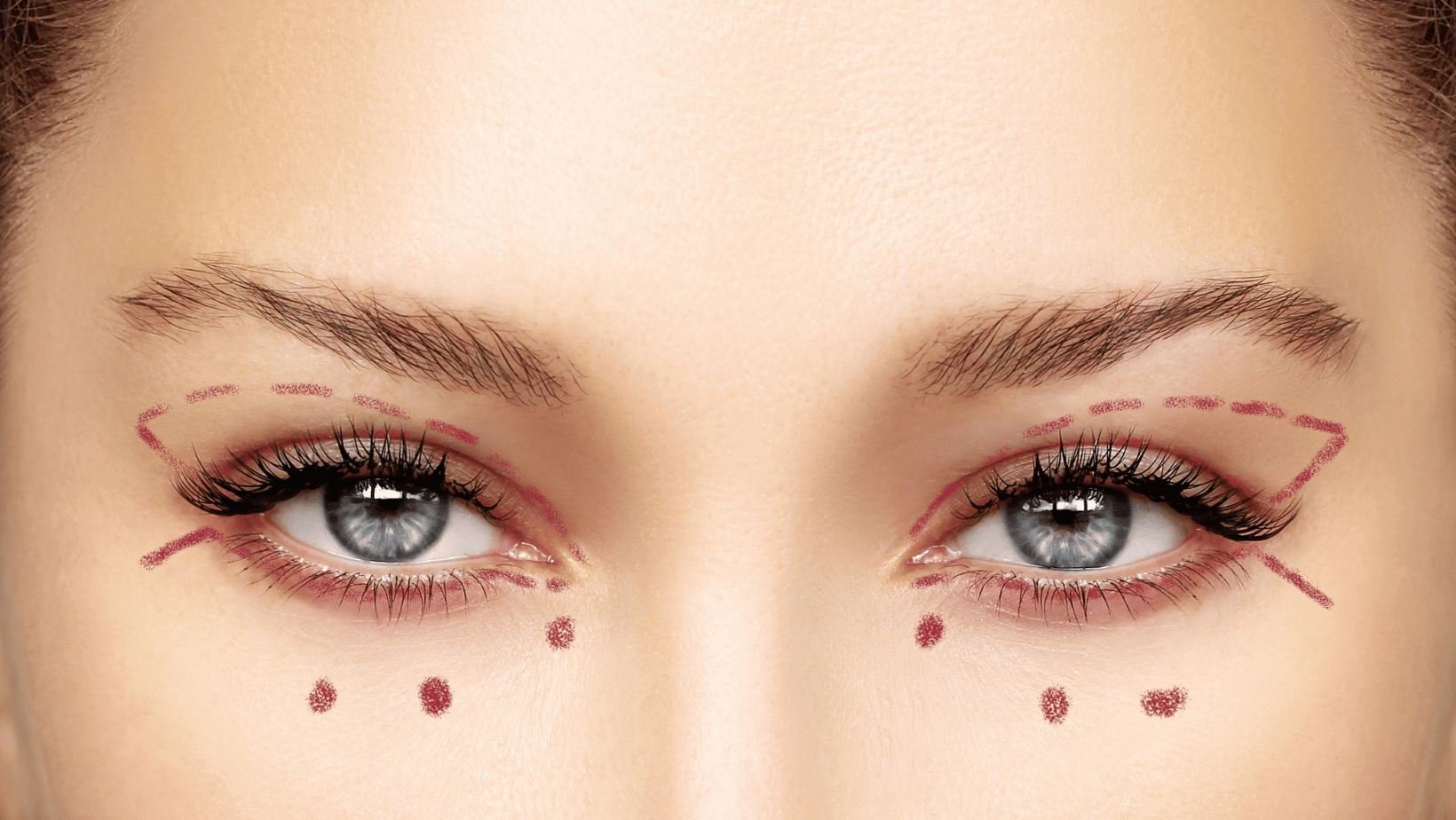 understanding-the-difference-between-upper-and-lower-eyelid-surgery-barbies-beauty-bits